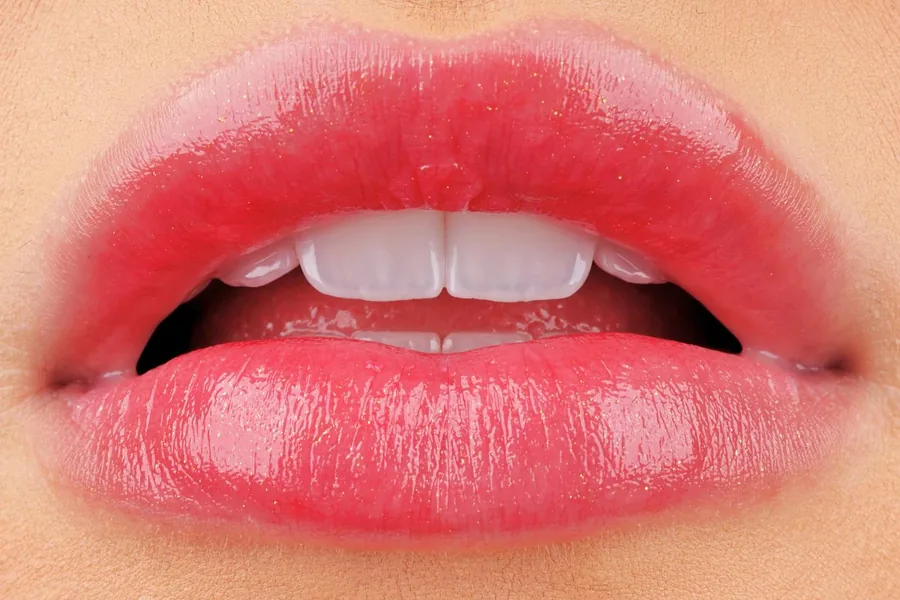 Anterior Close-Up — smile design result at Mineers Smile Center Beirut, Lebanon