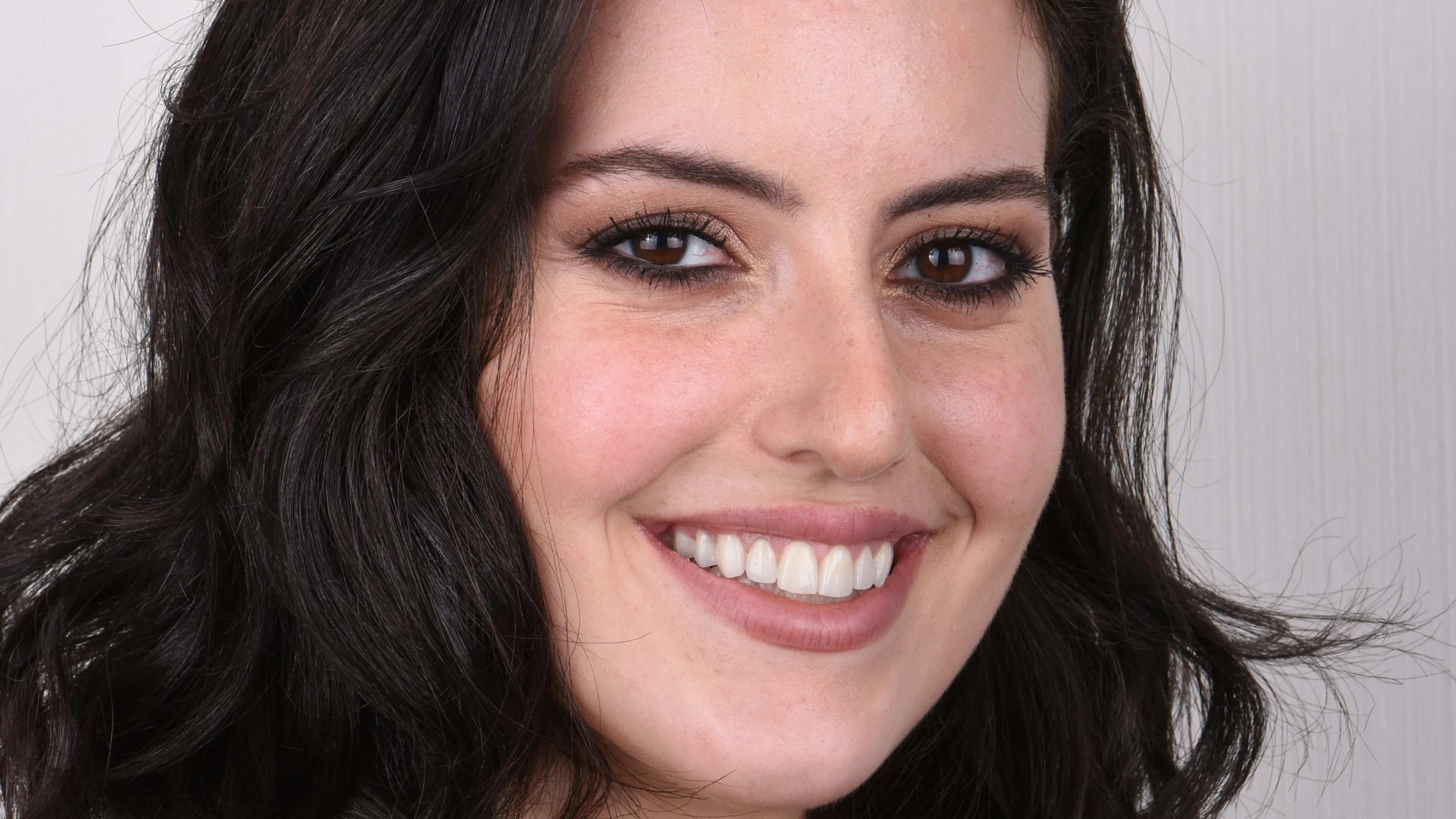 Porcelain veneers smile transformation at Mineers Smile Center Beirut